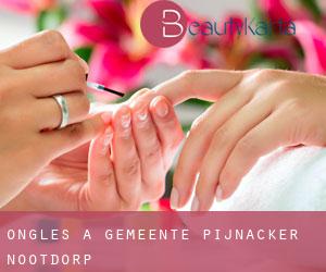 Ongles à Gemeente Pijnacker-Nootdorp Ongles à Gemeente Pijnacker-Nootdorp