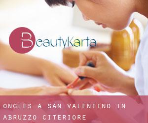 Ongles à San Valentino in Abruzzo Citeriore