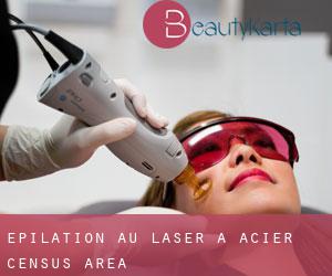 Épilation au laser à Acier (census area)