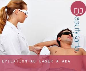 Épilation au laser à Ada