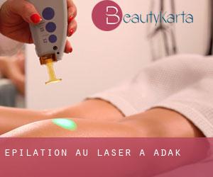 Épilation au laser à Adak