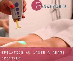 Épilation au laser à Adams Crossing