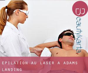 Épilation au laser à Adams Landing