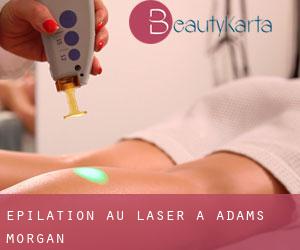 Épilation au laser à Adams Morgan