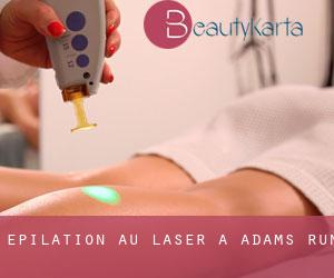 Épilation au laser à Adams Run