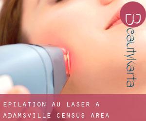 Épilation au laser à Adamsville (census area)