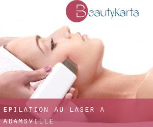 Épilation au laser à Adamsville