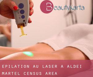 Épilation au laser à Aldéi-Martel (census area)