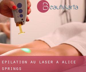 Épilation au laser à Alice Springs