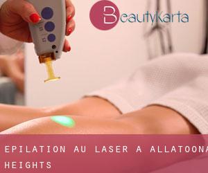 Épilation au laser à Allatoona Heights Épilation au laser à Allatoona Heights