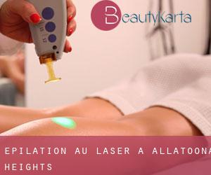 Épilation au laser à Allatoona Heights