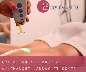 Épilation au laser à Allemanche-Launay-et-Soyer