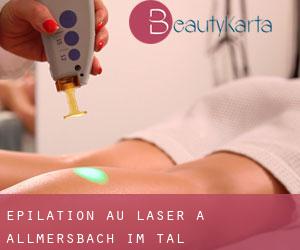 Épilation au laser à Allmersbach im Tal