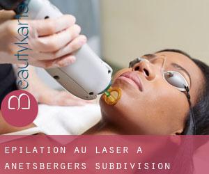 Épilation au laser à Anetsberger's Subdivision