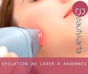 Épilation au laser à Ardennes