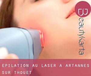 Épilation au laser à Artannes-sur-Thouet