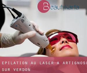 Épilation au laser à Artignosc-sur-Verdon