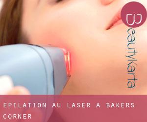 Épilation au laser à Bakers Corner