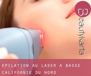 Épilation au laser à Basse-Californie du Nord