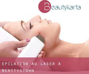 Épilation au laser à Beattystown Épilation au laser à Beattystown