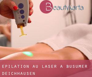 Épilation au laser à Büsumer Deichhausen