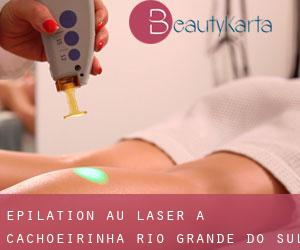Épilation au laser à Cachoeirinha (Rio Grande do Sul)