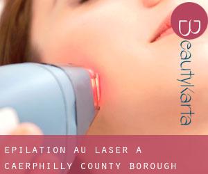 Épilation au laser à Caerphilly (County Borough)