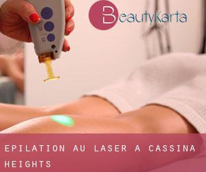 Épilation au laser à Cassina Heights