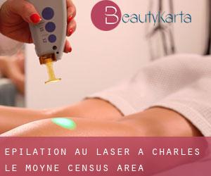Épilation au laser à Charles-Le Moyne (census area)