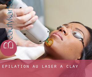 Épilation au laser à Clay