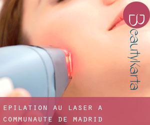 Épilation au laser à Communauté de Madrid