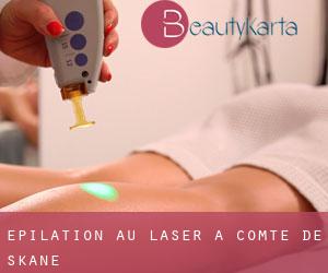 Épilation au laser à Comté de Skåne