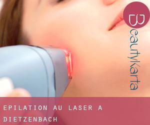 Épilation au laser à Dietzenbach