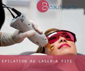 Épilation au laser à Fife