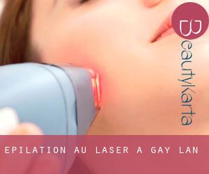 Épilation au laser à Gay Lan