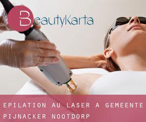 Épilation au laser à Gemeente Pijnacker-Nootdorp Épilation au laser à Gemeente Pijnacker-Nootdorp