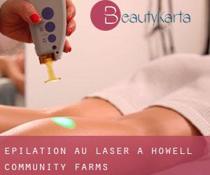 Épilation au laser à Howell Community Farms