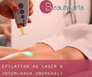 Épilation au laser à Interlaken-Oberhasli