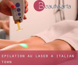 Épilation au laser à Italian Town