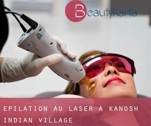 Épilation au laser à Kanosh Indian Village
