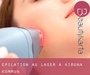 Épilation au laser à Kiruna Kommun Épilation au laser à Kiruna Kommun
