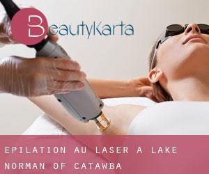 Épilation au laser à Lake Norman of Catawba