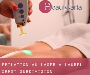 Épilation au laser à Laurel Crest Subdivision