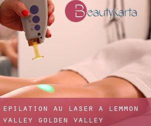 Épilation au laser à Lemmon Valley-Golden Valley