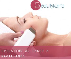 Épilation au laser à Magallanes Épilation au laser à Magallanes