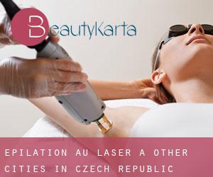 Épilation au laser à Other Cities in Czech Republic