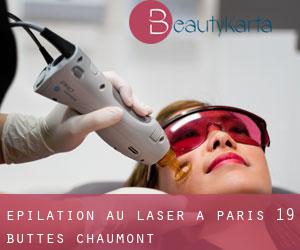 Épilation au laser à Paris 19 Buttes-Chaumont