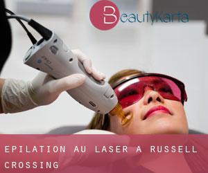 Épilation au laser à Russell Crossing