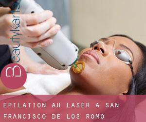 Épilation au laser à San Francisco de los Romo