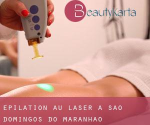 Épilation au laser à São Domingos do Maranhão